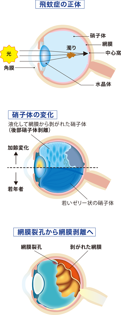 ishibazawa2412