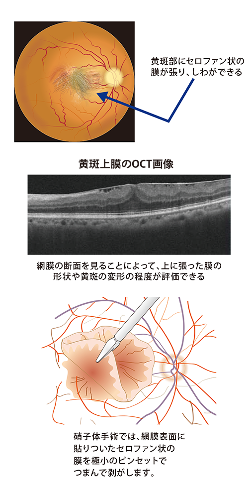 ishibazawa2503